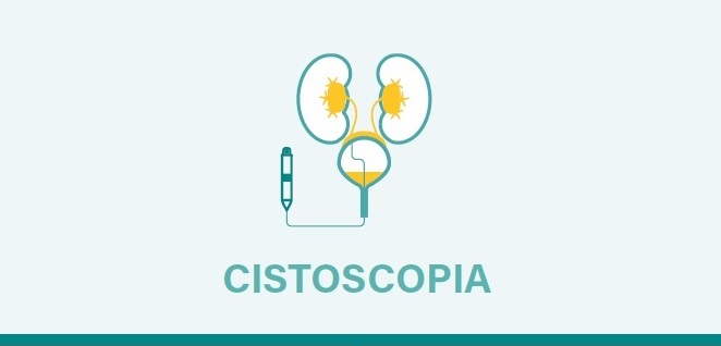Cistectomia 1