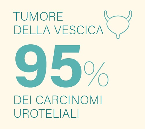 95% dei carcinomi uroteriali